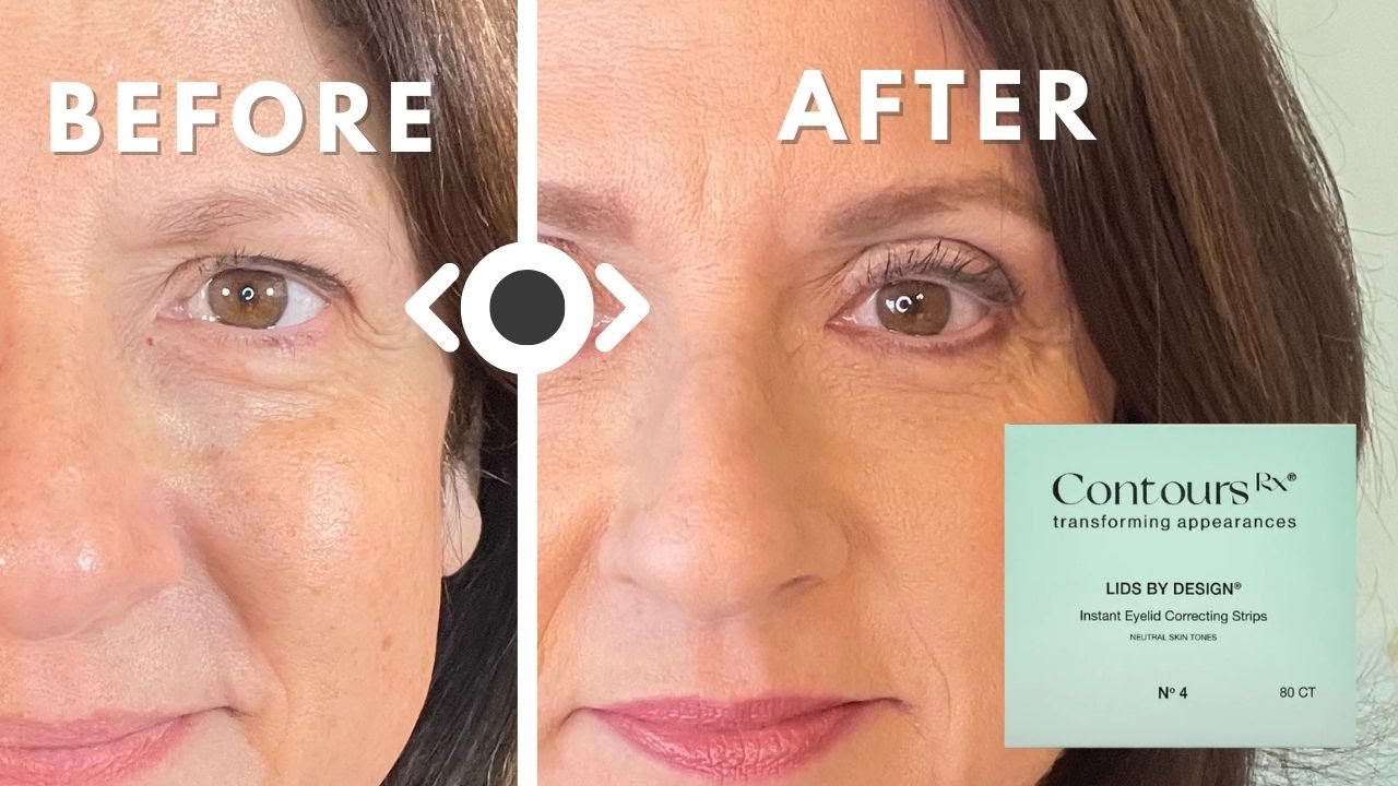 Trying Eyelid Tape on Sagging Lids - Real Results