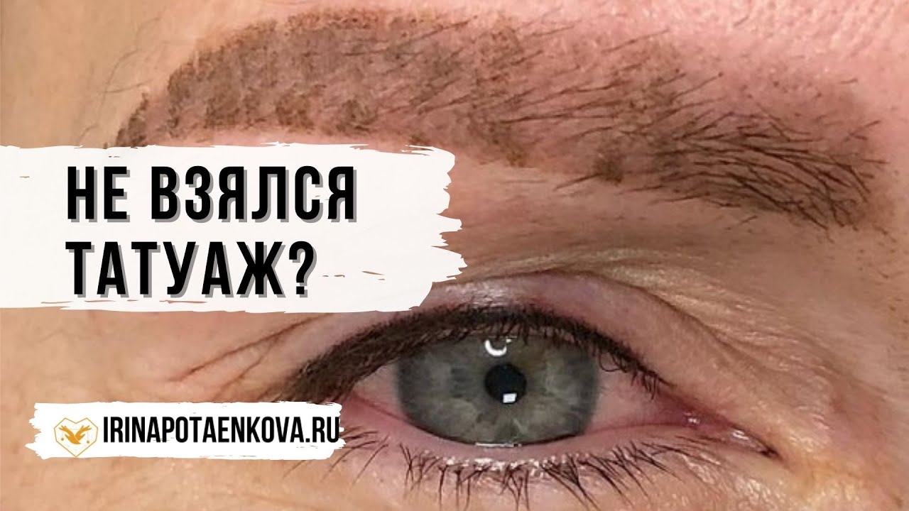 Татуаж НЕ ВЗЯЛСЯ😱 Травматизация кожи