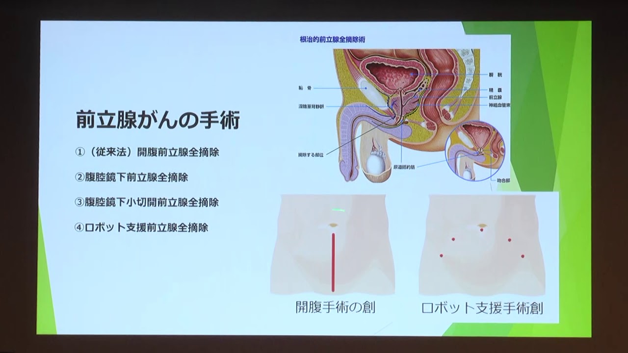 令和2年1月25日⑤「泌尿器がんのロボット支援手術について」（泌尿器科科長兼副部長 酒井 康之）