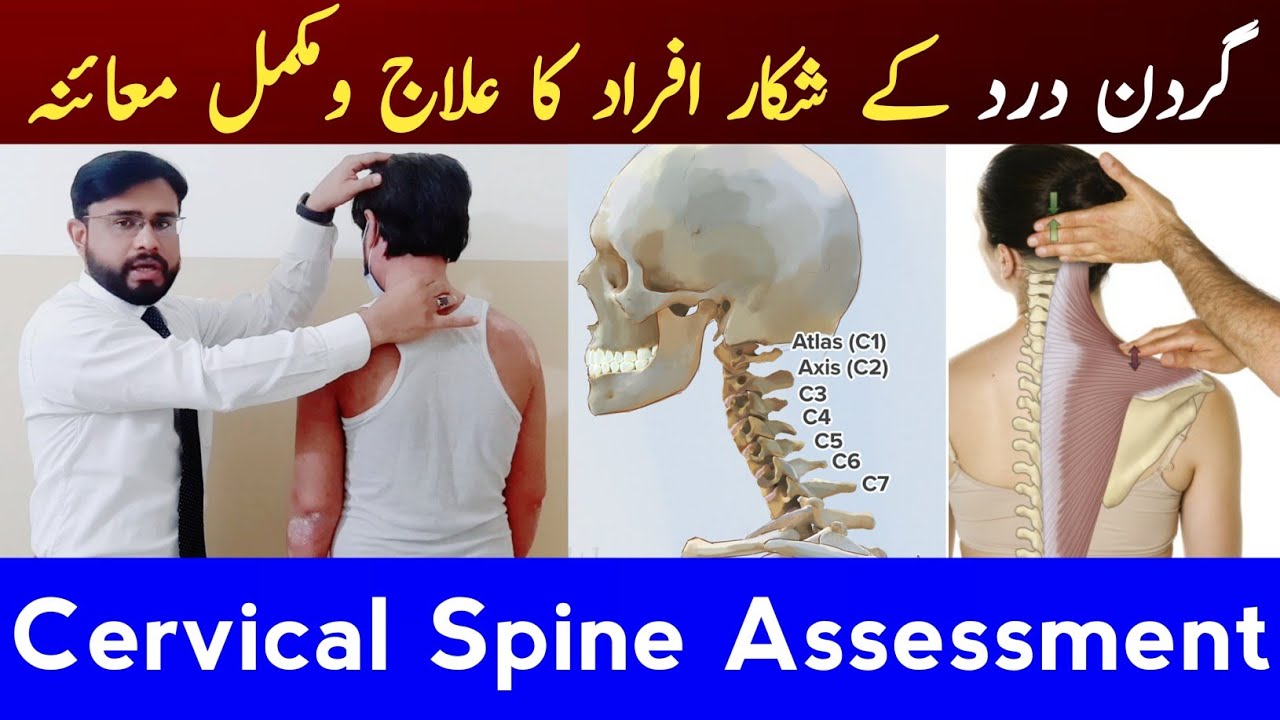 Cervical Spine Assessment | Complete Neck Examination | Gardan Dard Ka Ilaj | Dr. Noman 03008881254