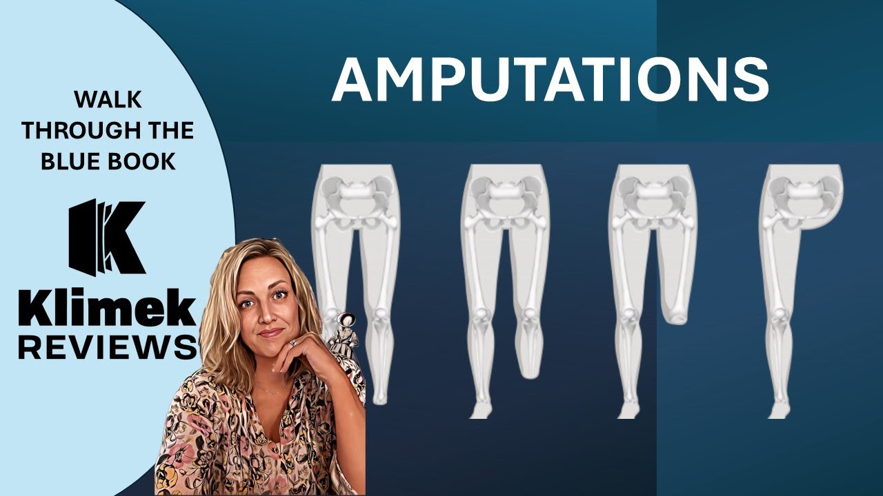 NCLEX PREP: AMPUTATIONS + questions with Dr. Sharon