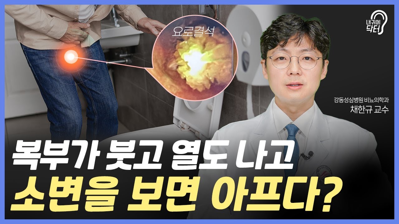 요로결석을 방치하니&hellip; 신장이 붓는다고?👨&zwj;🔬