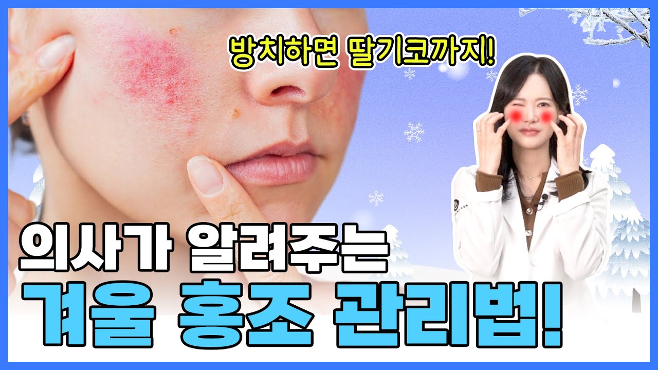 겨울 홍조, 방치하면 딸기코까지? 의사가 알려주는 겨울 홍조 없애는 방법! 부천홍조치료, 부천홍조스킨케어, 부천홍조레이저