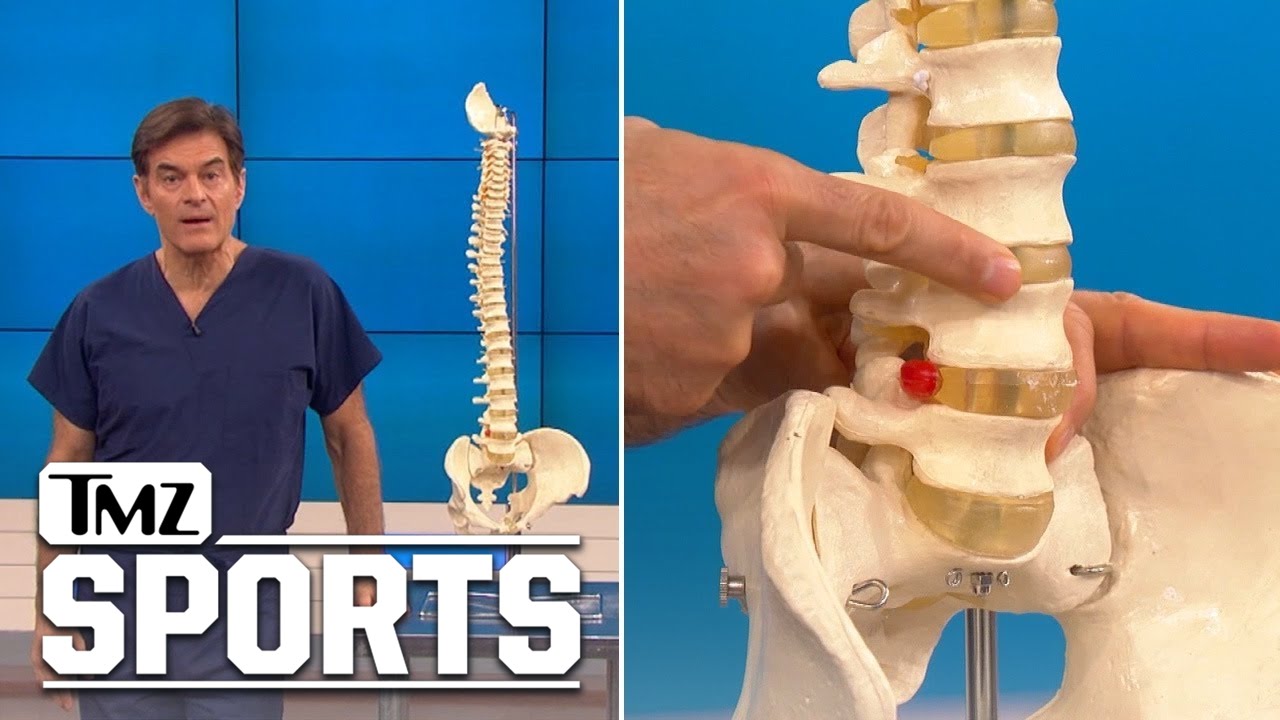 Rob Gronkowski -- Dr. Oz Explains Back Injury ... Here's Why He Needs Surgery | TMZ Sports
