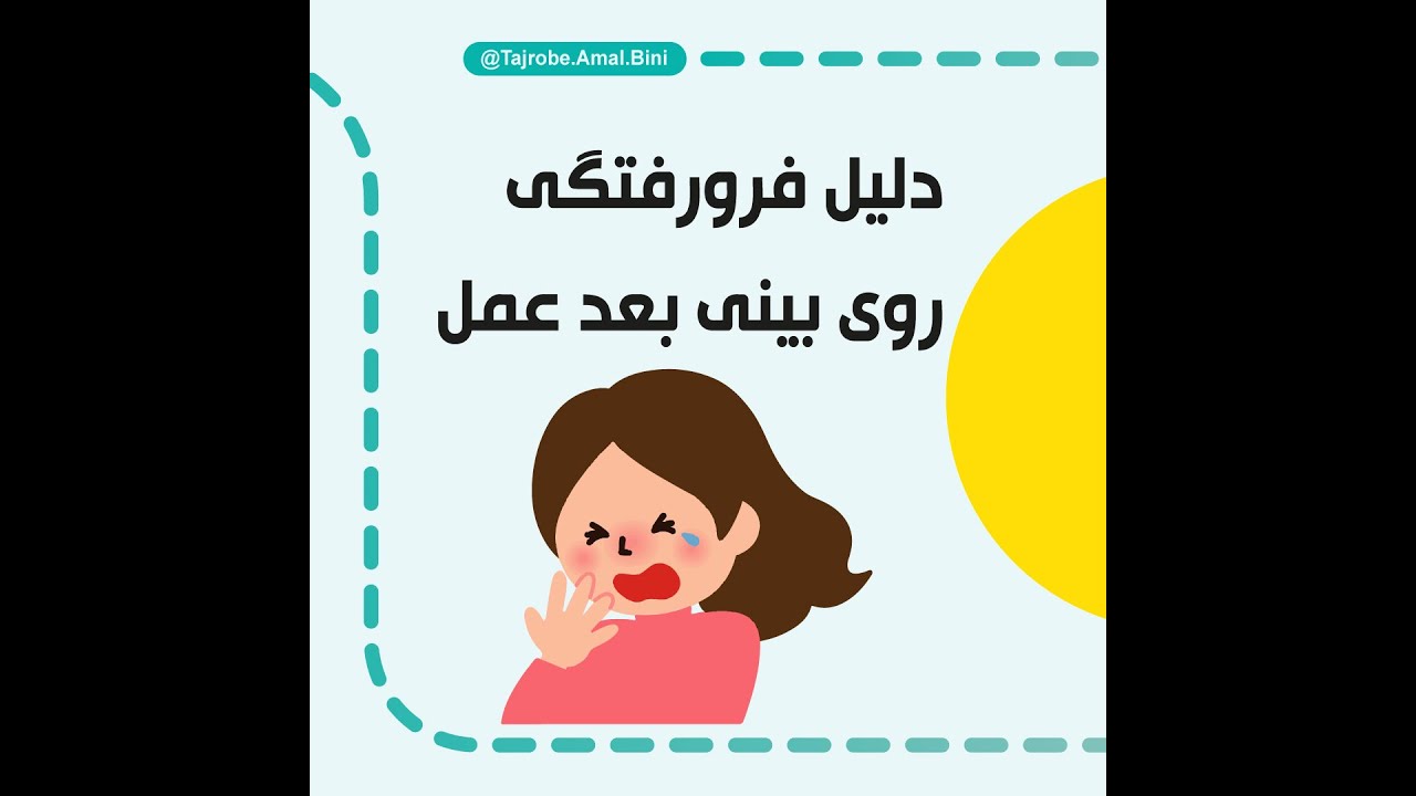 فرورفتگی بینی بعد از عمل