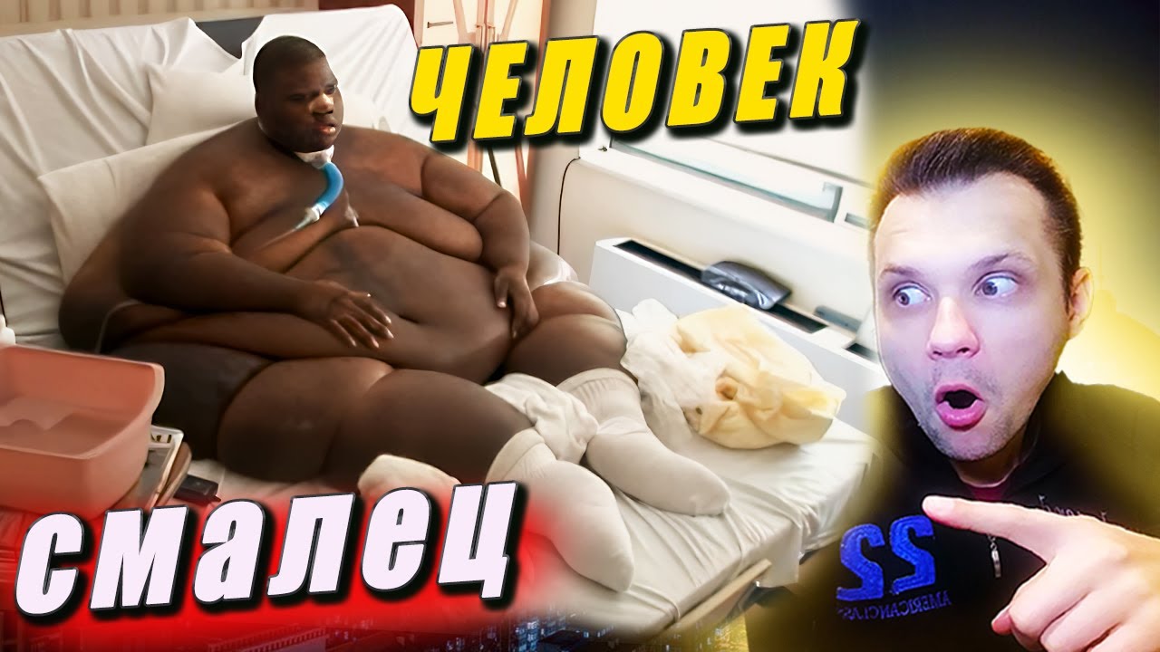 ШОК ЧЕЛОВЕК СМАЛЕЦ | Больница для толстяков выпуск 1