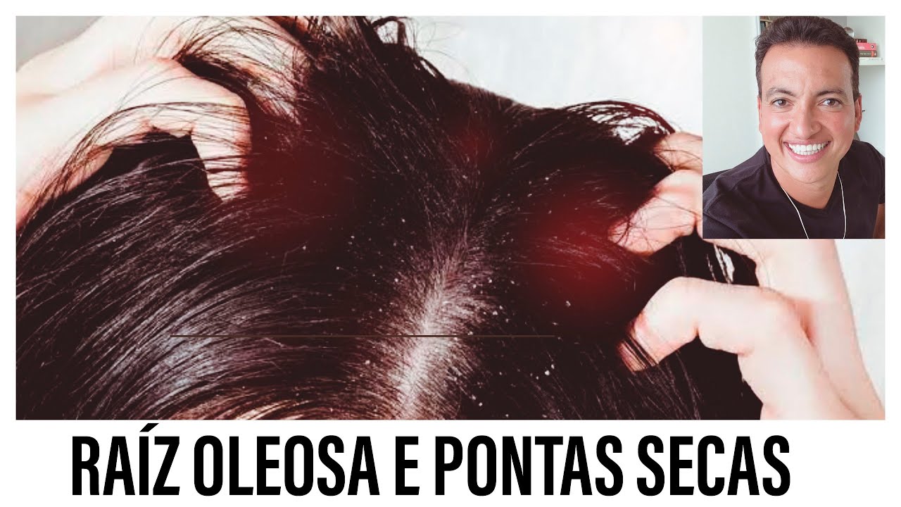 RA&Iacute;Z OLEOSA E PONTAS SECAS, O QUE FAZER??????