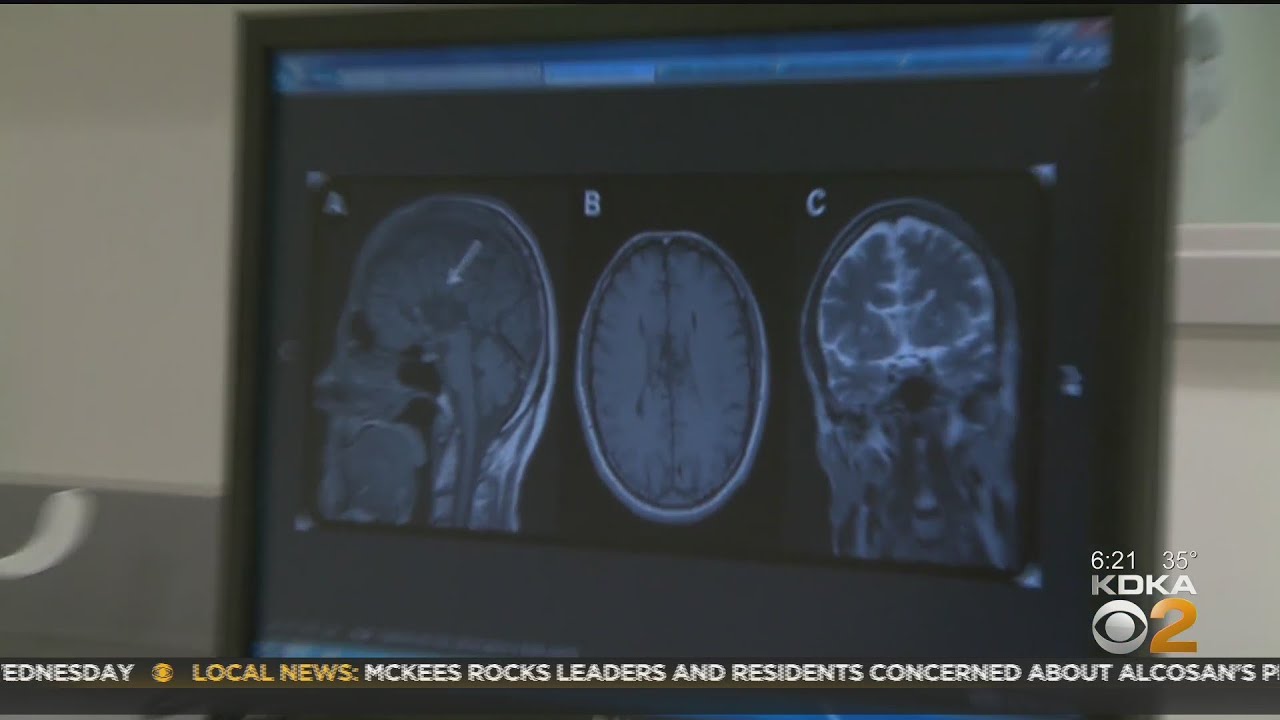 Digital Amnesia: Keeping Up With Brain Health (Pt. 1)