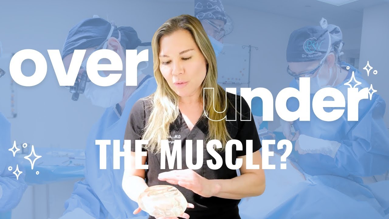 Over vs Under the Muscle Implants: What&rsquo;s Best for You? | Plastic Surgeon Explains