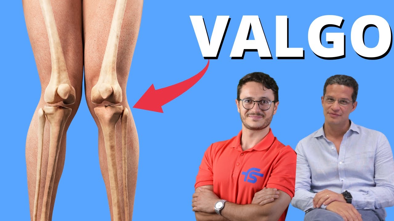 Ginocchio Valgo o Varo: Possibile raddrizzarlo?