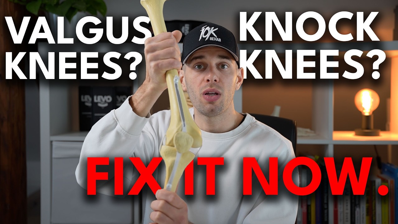 Your Knock Knees Problem Isn't What You Think