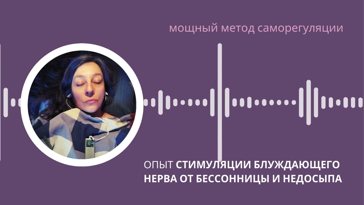 Опыт стимуляции блуждающего нерва от бессонницы и недосыпа
