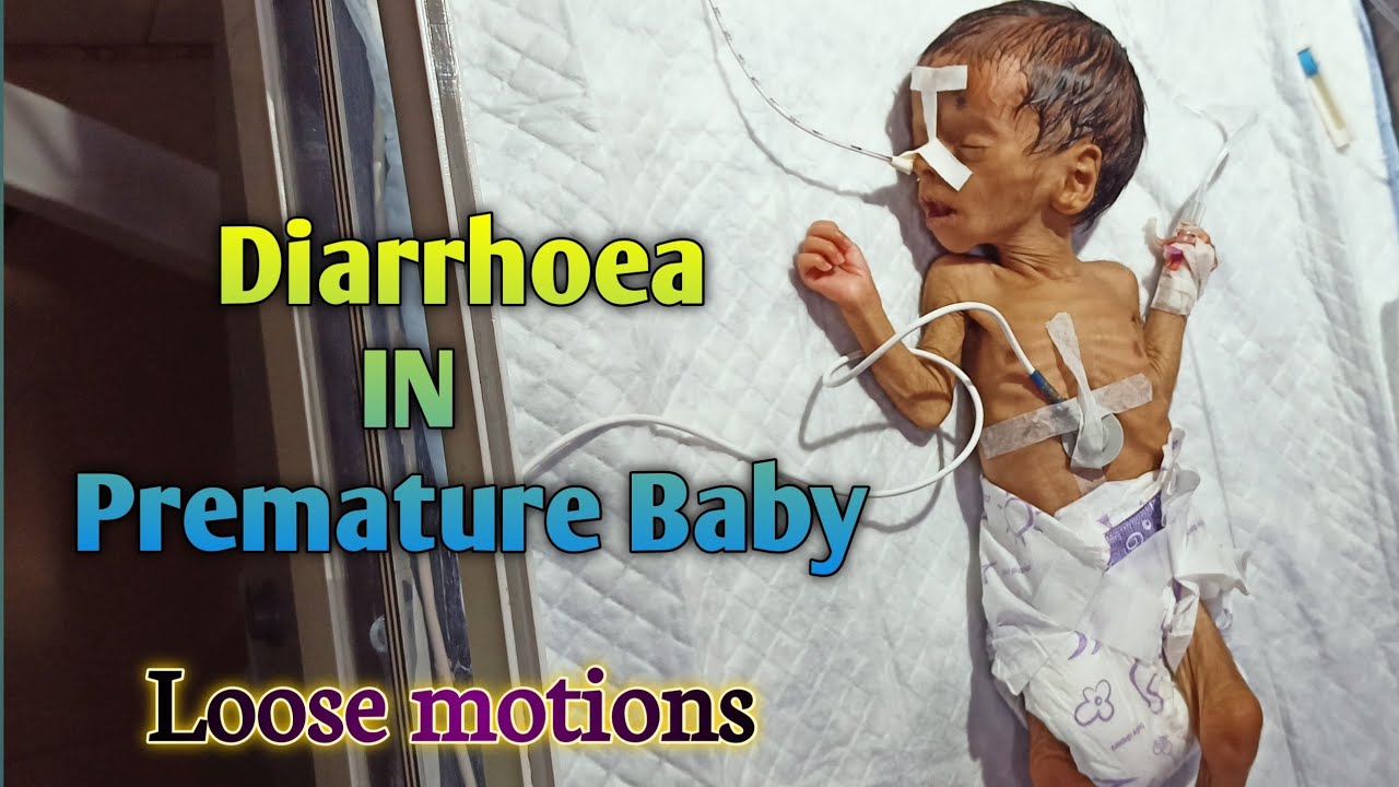 What is Diarrhea? Causes, Signs and Symptoms, Diagnosis and Treatment 