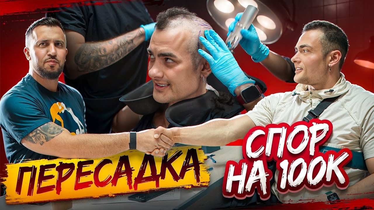 ПЕРЕСАДКА ВОЛОС СИМКИНУ / СПОР НА 100к, что похудею 