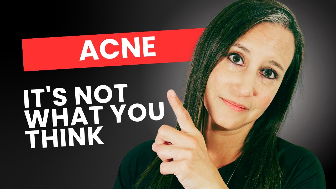 You’re Treating Acne Wrong, Here’s Why It Won’t Heal