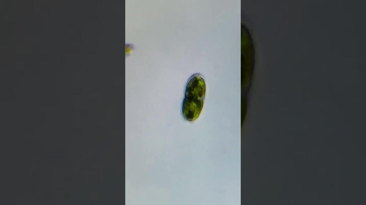 Cylindrocystis brebissonii