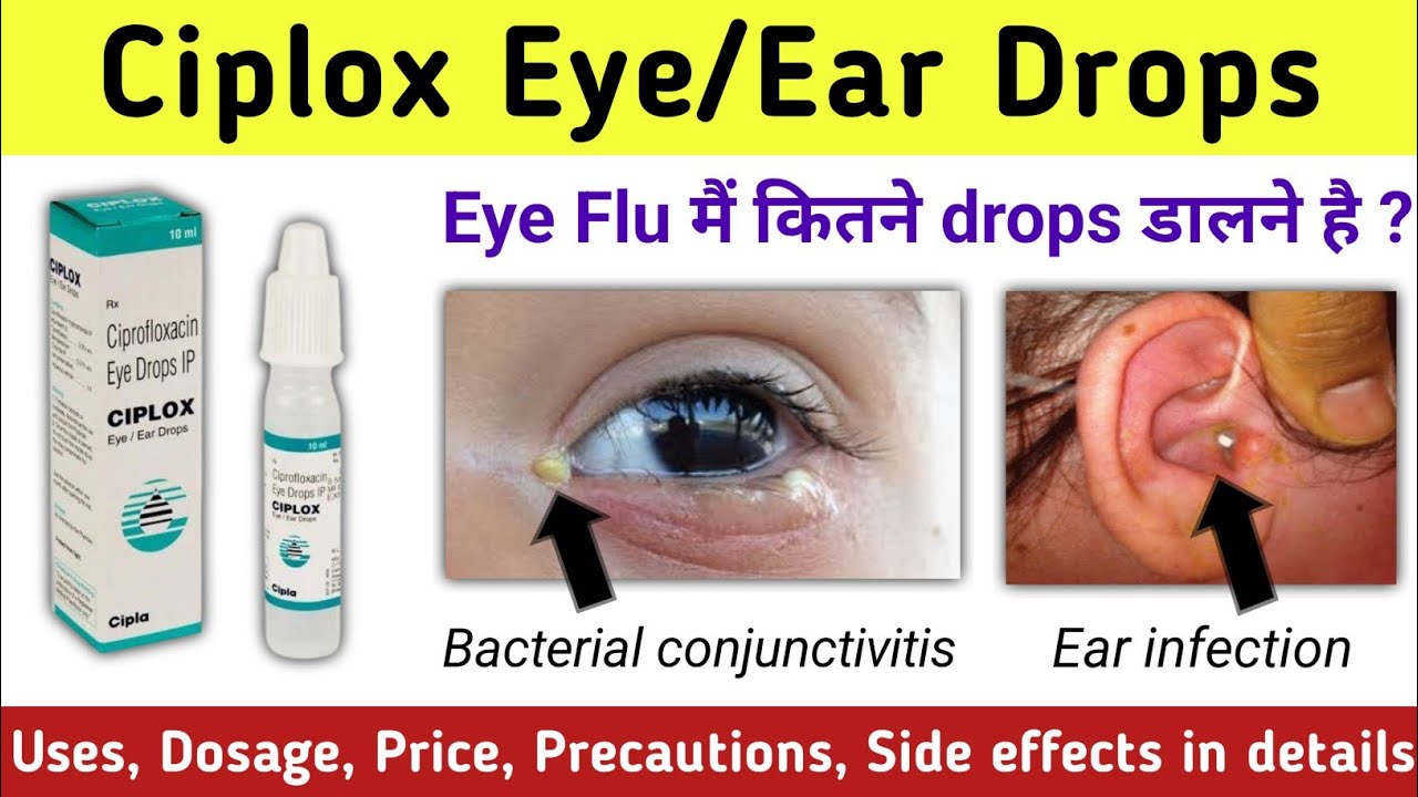 Ciprofloxacin eye drops | Ciplox Eye drops | Ciprofloxacin eye drops ip ciplox | Ciplox ear drops |