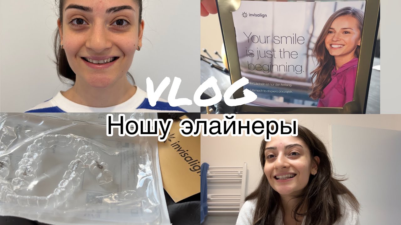 VLOG//Ношу элайнеры//Мой опыт/