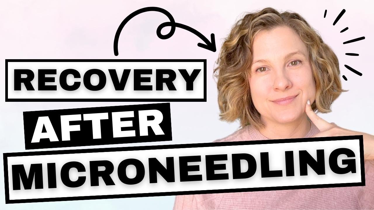 Microneedling Aftercare Tips (best results for anti-aging skincare)