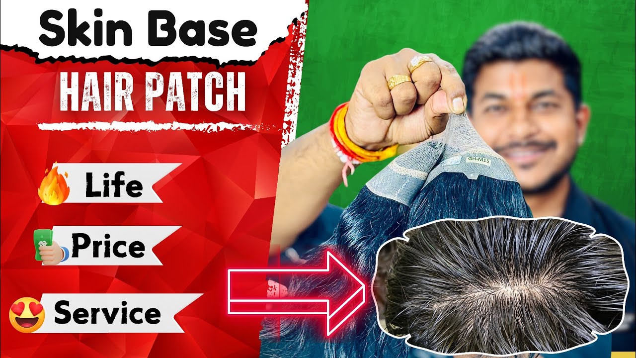 Everything about Mirage Hair Patch | Natural Hair Patch for Man #mirage #hairpatch #viral #hairwig
