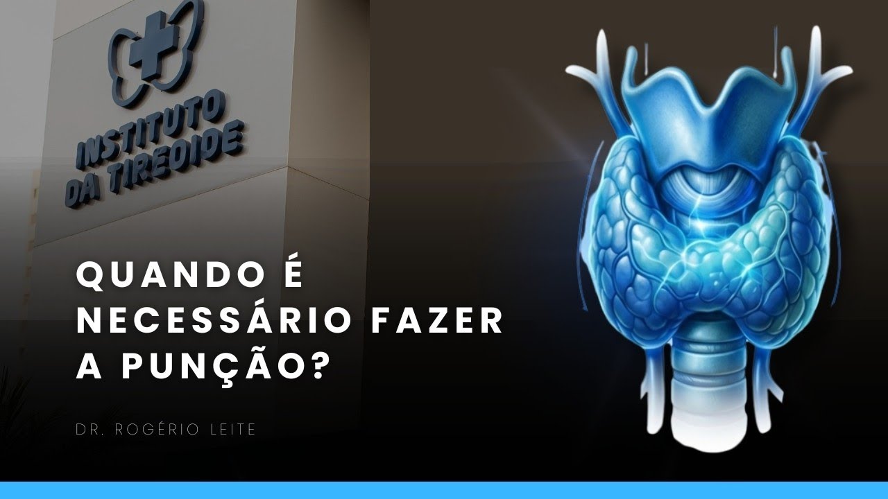 Quando é necessário fazer a punção na tireoide? 