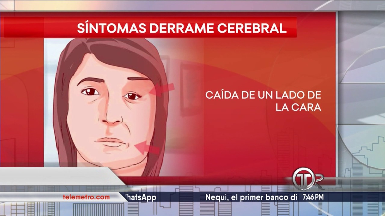 Infarto o derrame cerebral