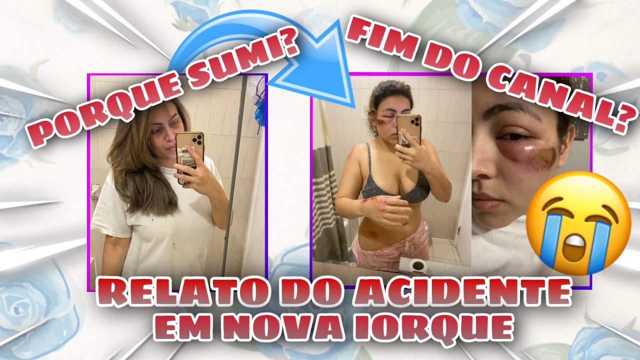 PORQUE SUMI DO YOUTUBE? | SOFRI UM ACIDENTE NOS ESTADOS UNIDOS  E CONTEI TUDO NESSE VIDEO