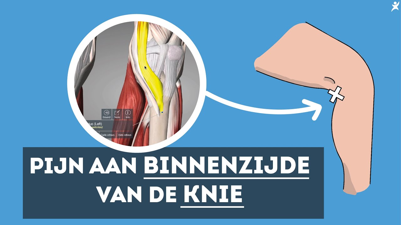 Pijn binnenkant knie? Ontdek de oplossing