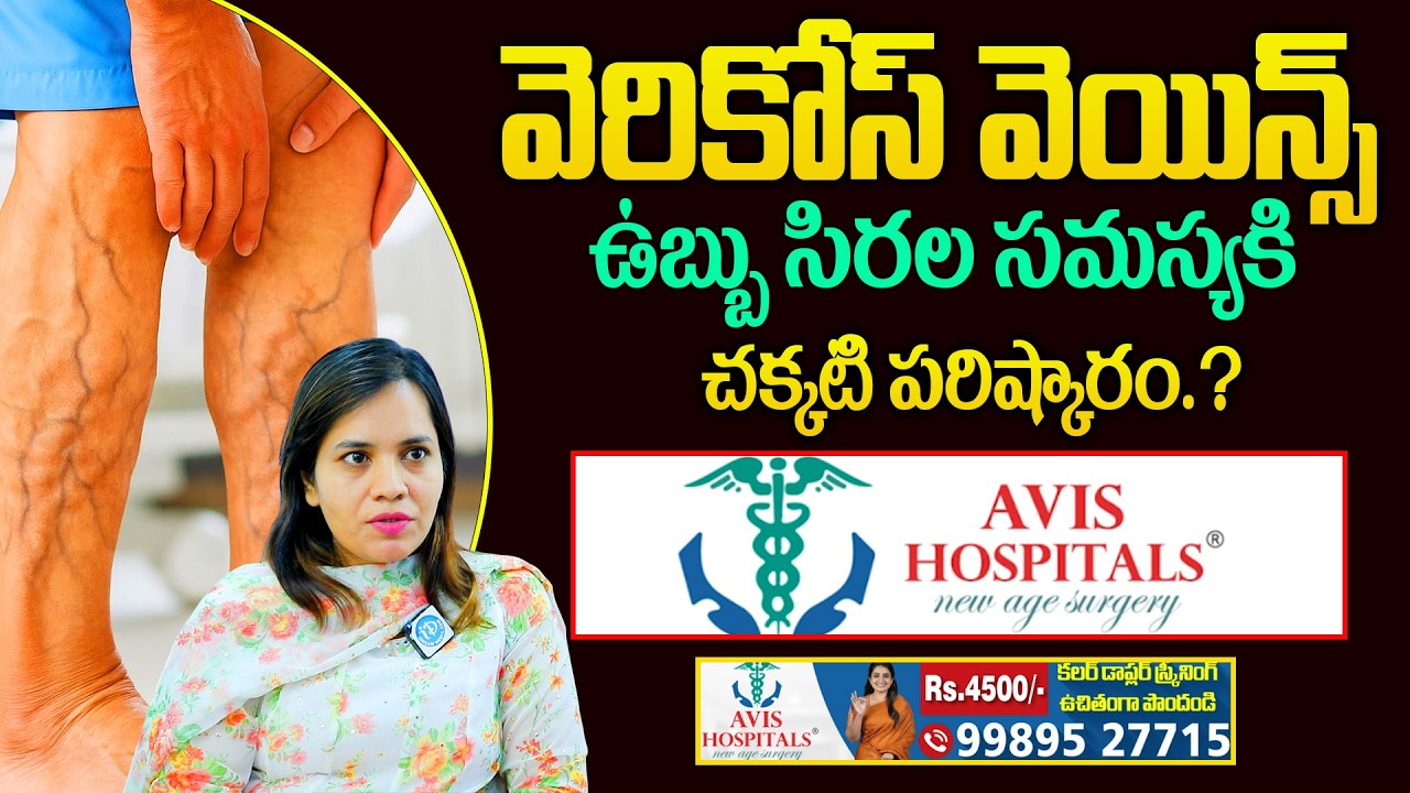 వెరికోస్ వెయిన్స్ సమస్యకి చక్కటి పరిష్కారం | Avis Hospitals | Dr Harika |@idsuperhealth