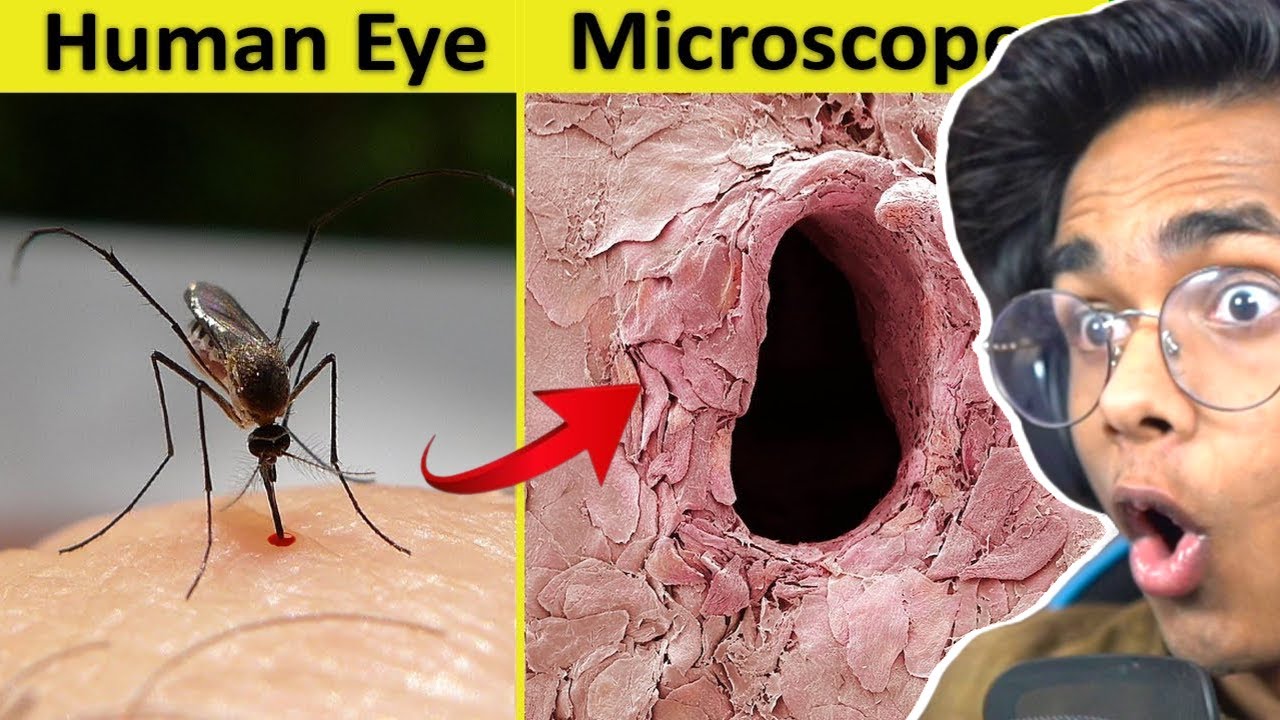 Things You Can See Only Under Microscope