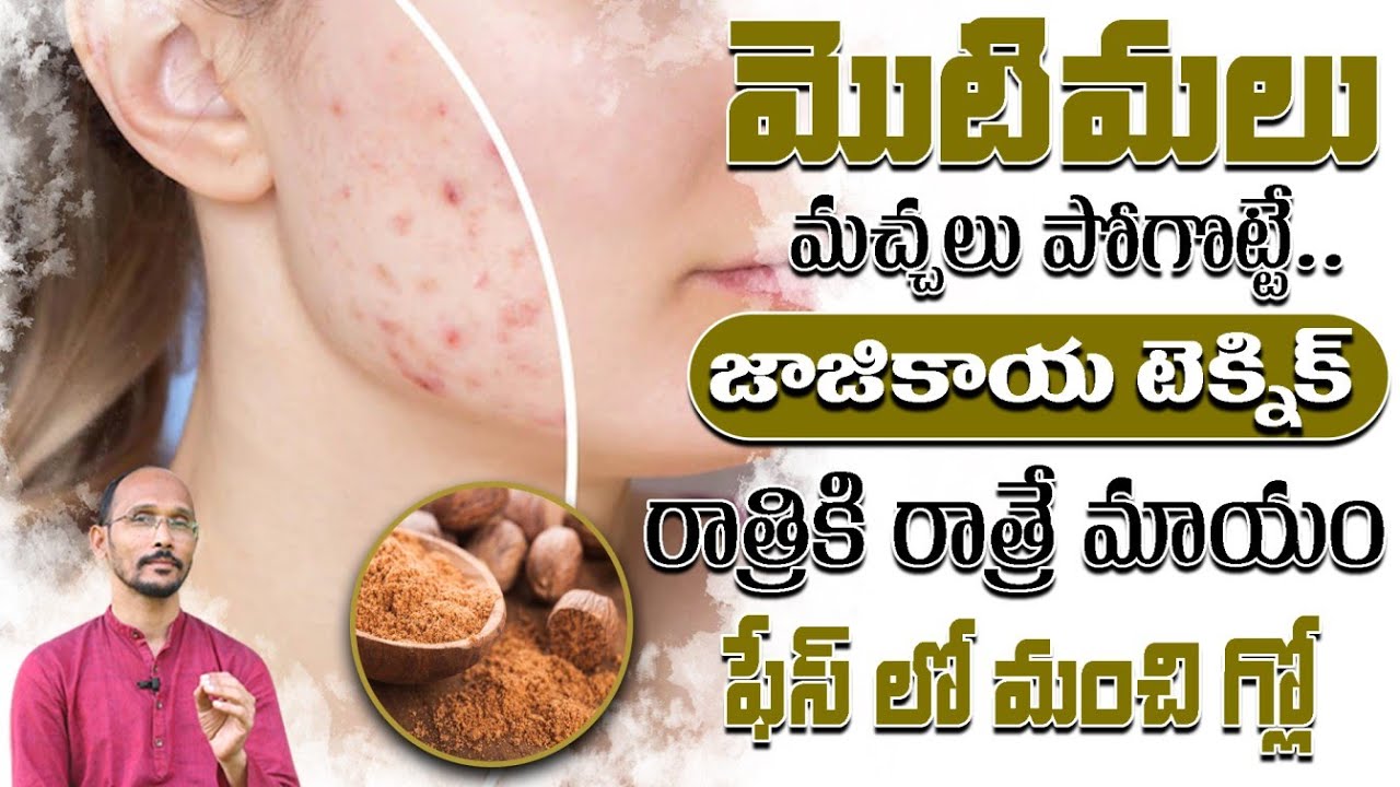 మొటిమలు మచ్చలు పోగొట్టే..జాజికాయ టెక్నిక్ రాత్రికి రాత్రే మాయం | Dr. MadhuBabu | Health Trends |