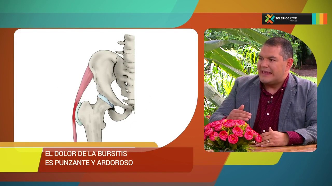 ¿Qué es bursitis de cadera?