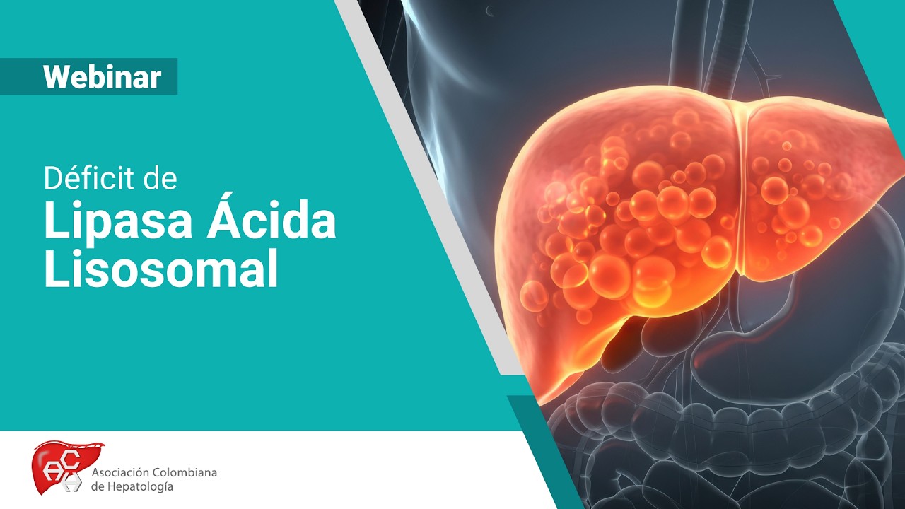 Webinar: Déficit de Lipasa Ácida Lisosomal