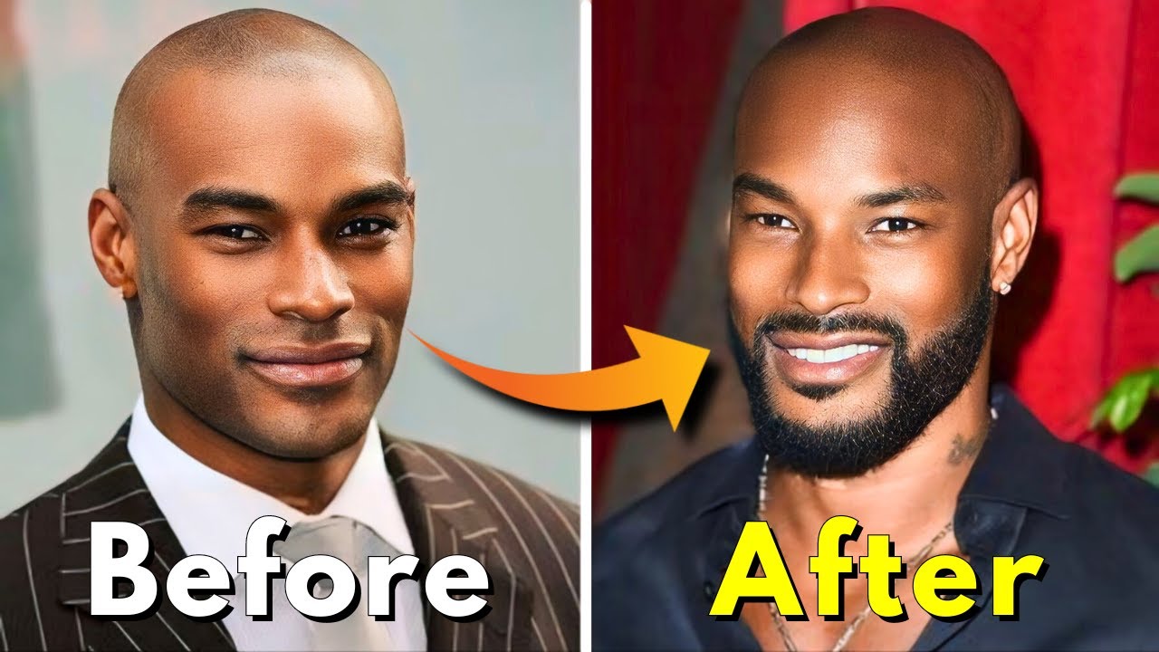 Grow your Beard Faster as a Black Men