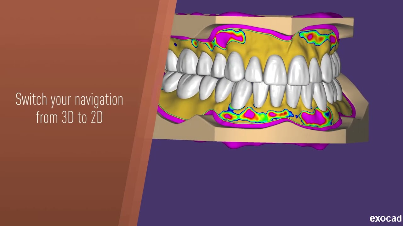 Exocad x 3Dconnexion - SpaceMouse benefits and features