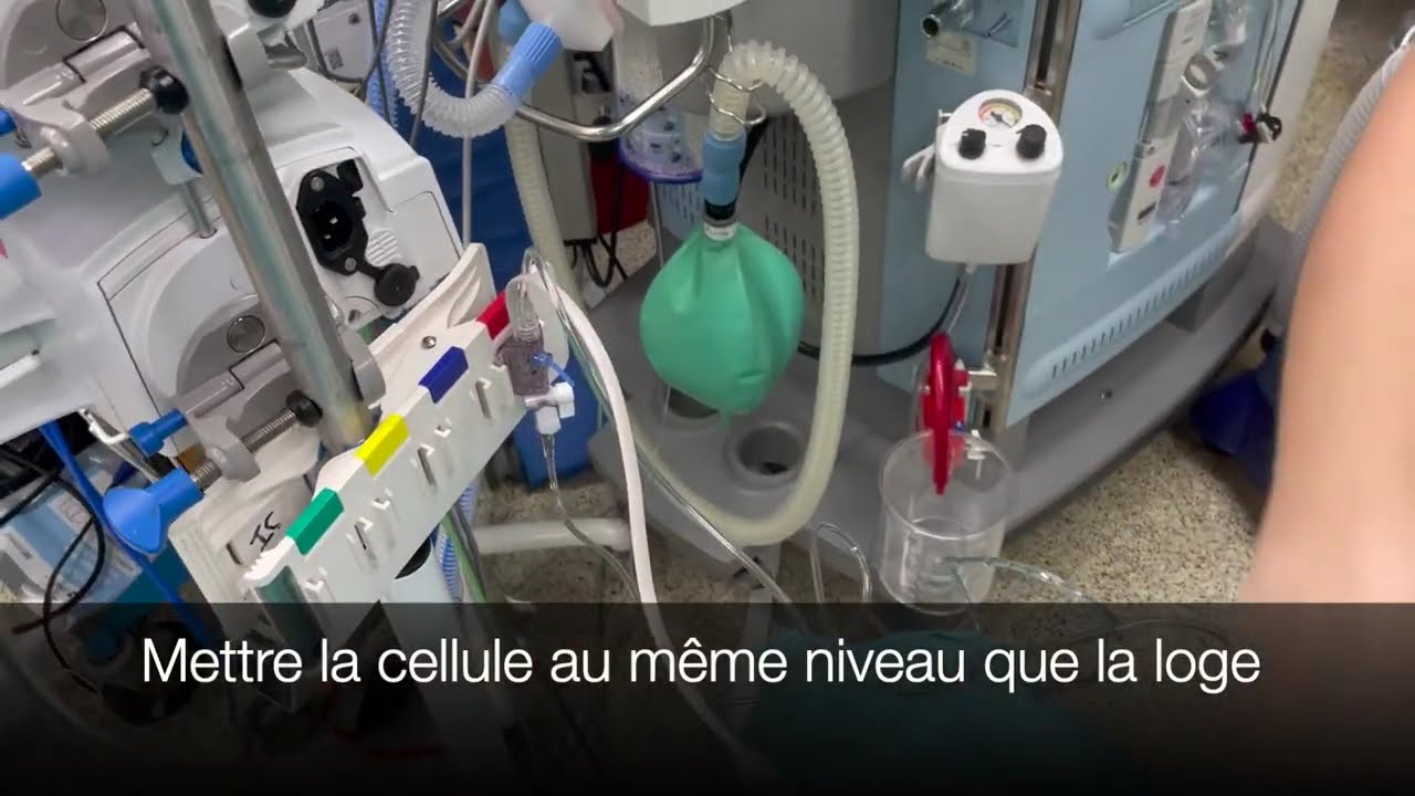 Mesure de pression dans une loge en utilisant une ligne artérielle