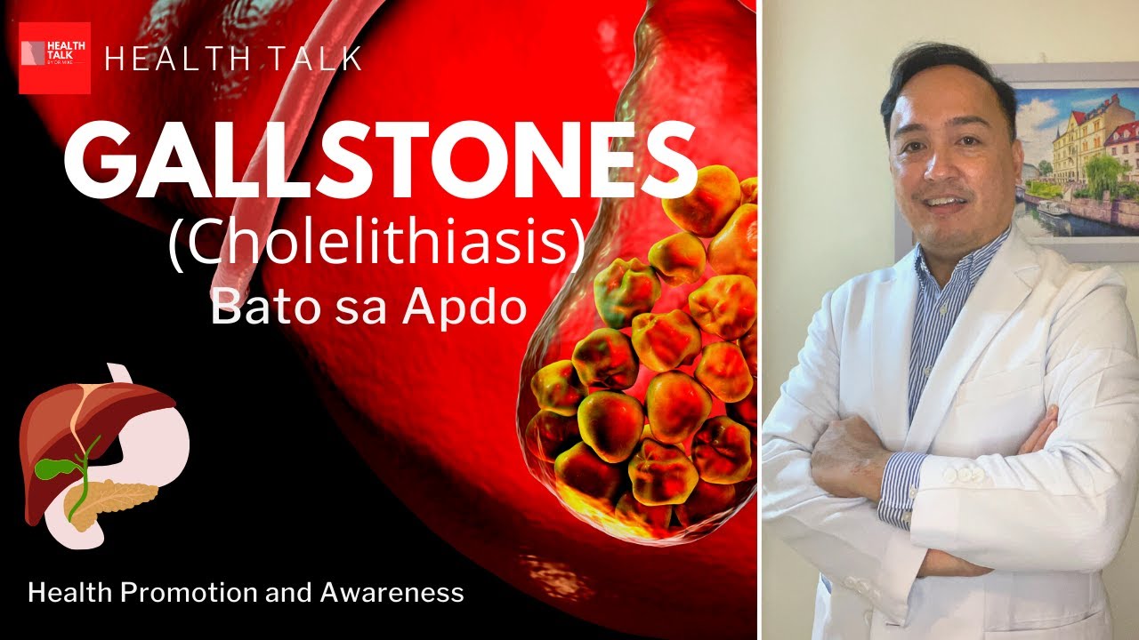 Gallstones: Causes, Clinical Features and Prevention