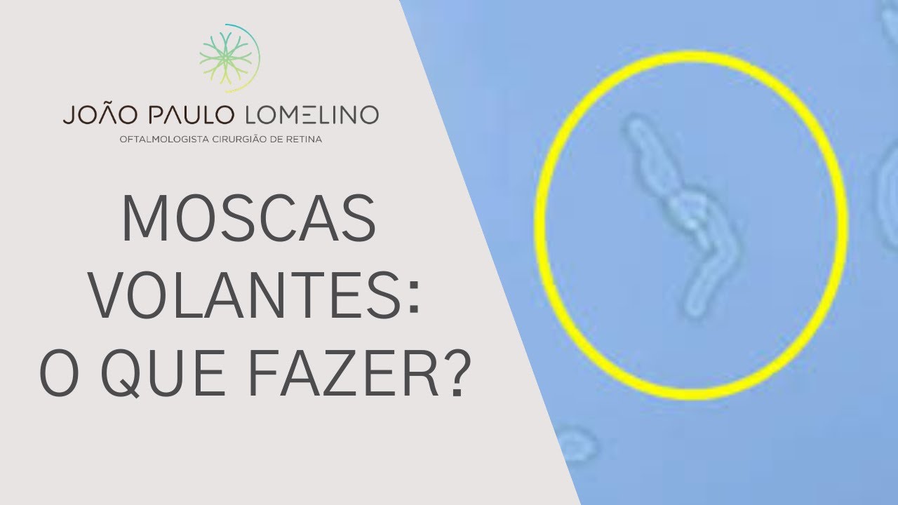 Moscas volantes nos olhos | Dr. Jo&atilde;o Paulo Lomelino