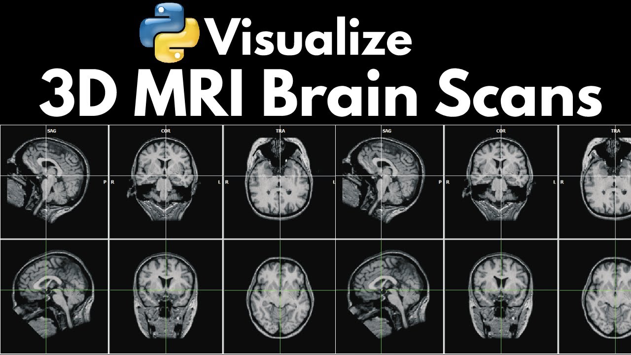 Neuroimaging: Visualize 3D MRI Brain Scans with Python