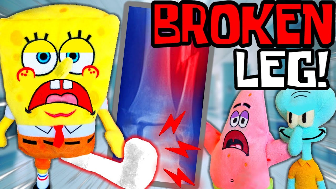Spongebob's Broken Leg! - Spongebob Network
