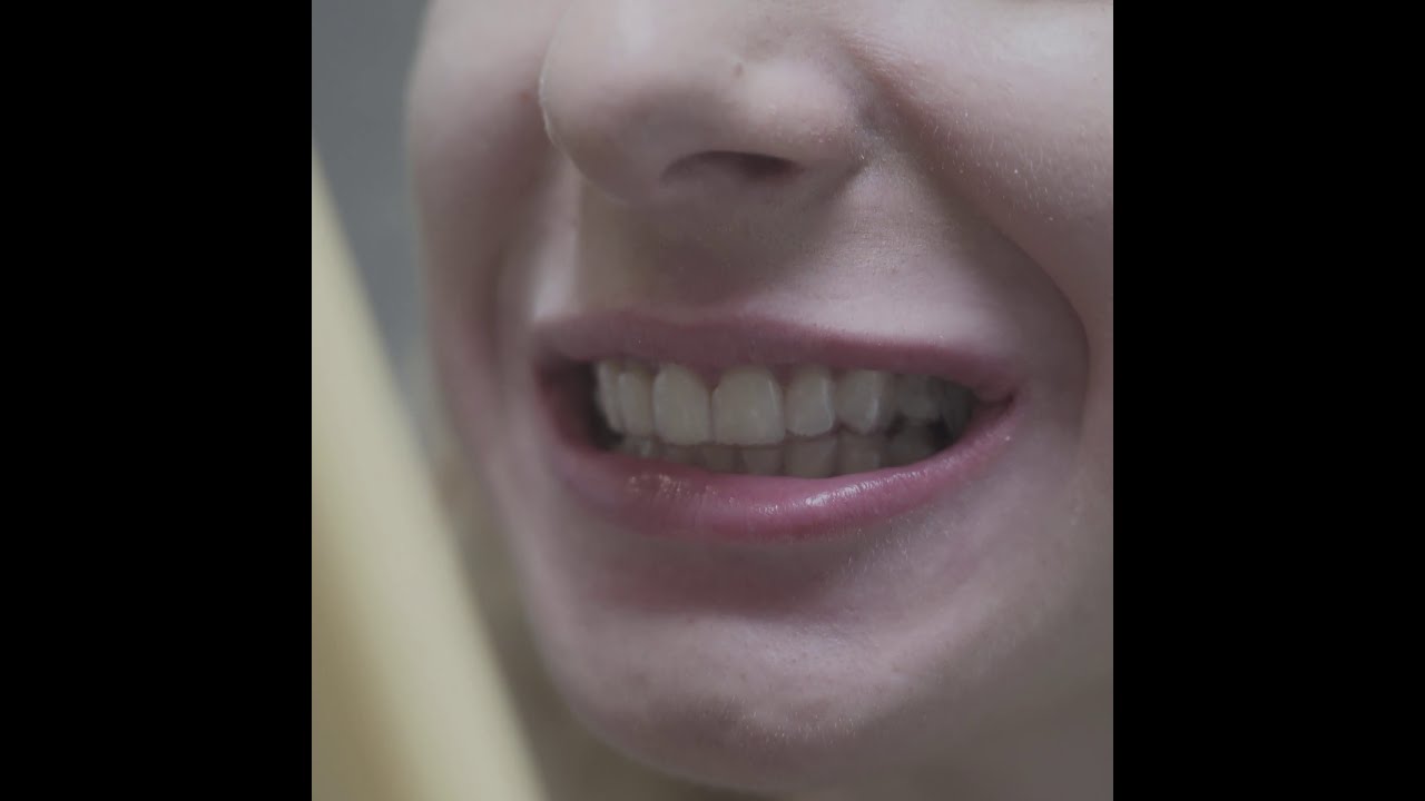 Neviditeľný zubný strojček Invisalign v Poprad