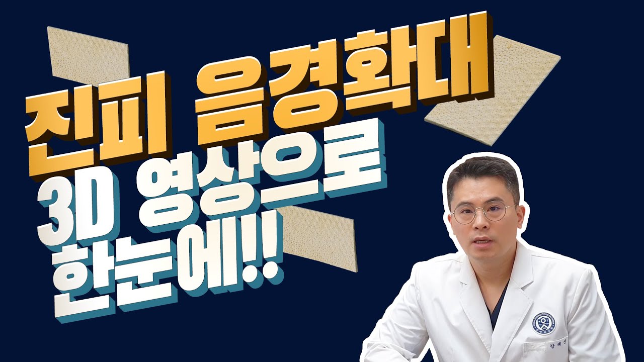 3D 영상으로 알아보는 진피음경확대수술의 방법과 전후변화, 부작용