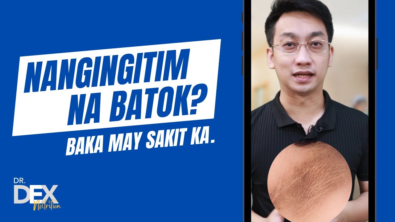 Nangingitim na batok? Baka may sakit ka.