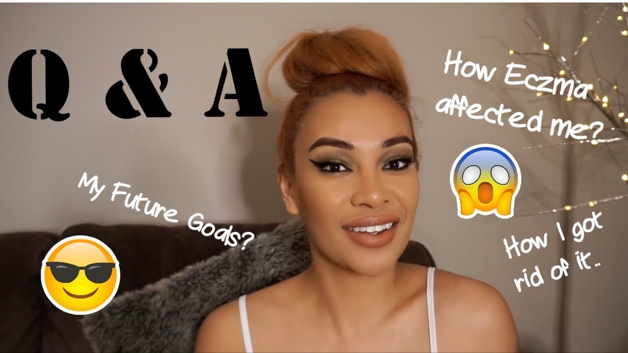 GET TO KNOW ME TAG | How I dealt with Eczema