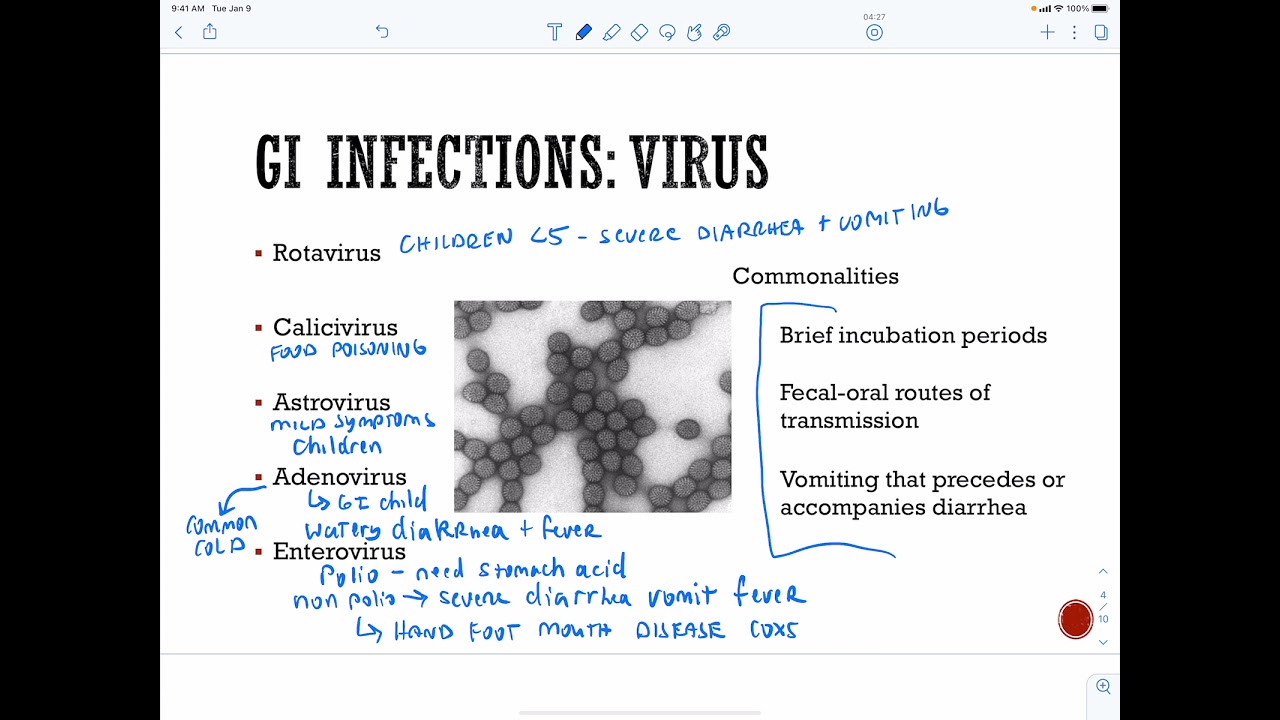 GI infections   viral