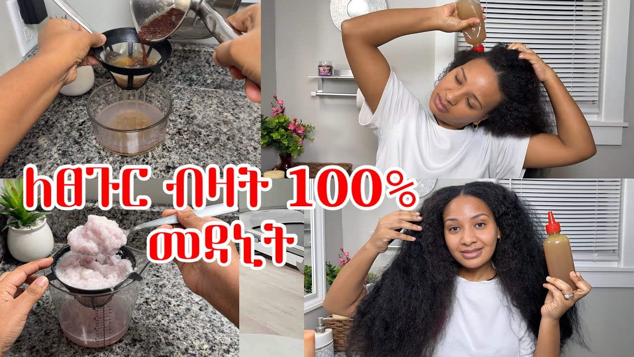 ለሚነቀል ለሳሳ ለፈጣን የፀጉር እድገት ለቆዳ ጤና ለፎሮፎር ምርጥ ነው! 𝐅𝐨𝐫 𝐡𝐚𝐢𝐫 𝐥𝐨𝐬𝐬, 𝐝𝐚𝐧𝐝𝐫𝐮𝐟𝐟, 𝐡𝐞𝐚𝐭𝐡𝐲 𝐬𝐜𝐚𝐥𝐩, 𝐡𝐚𝐢𝐫 𝐠𝐫𝐨𝐰𝐭𝐡 