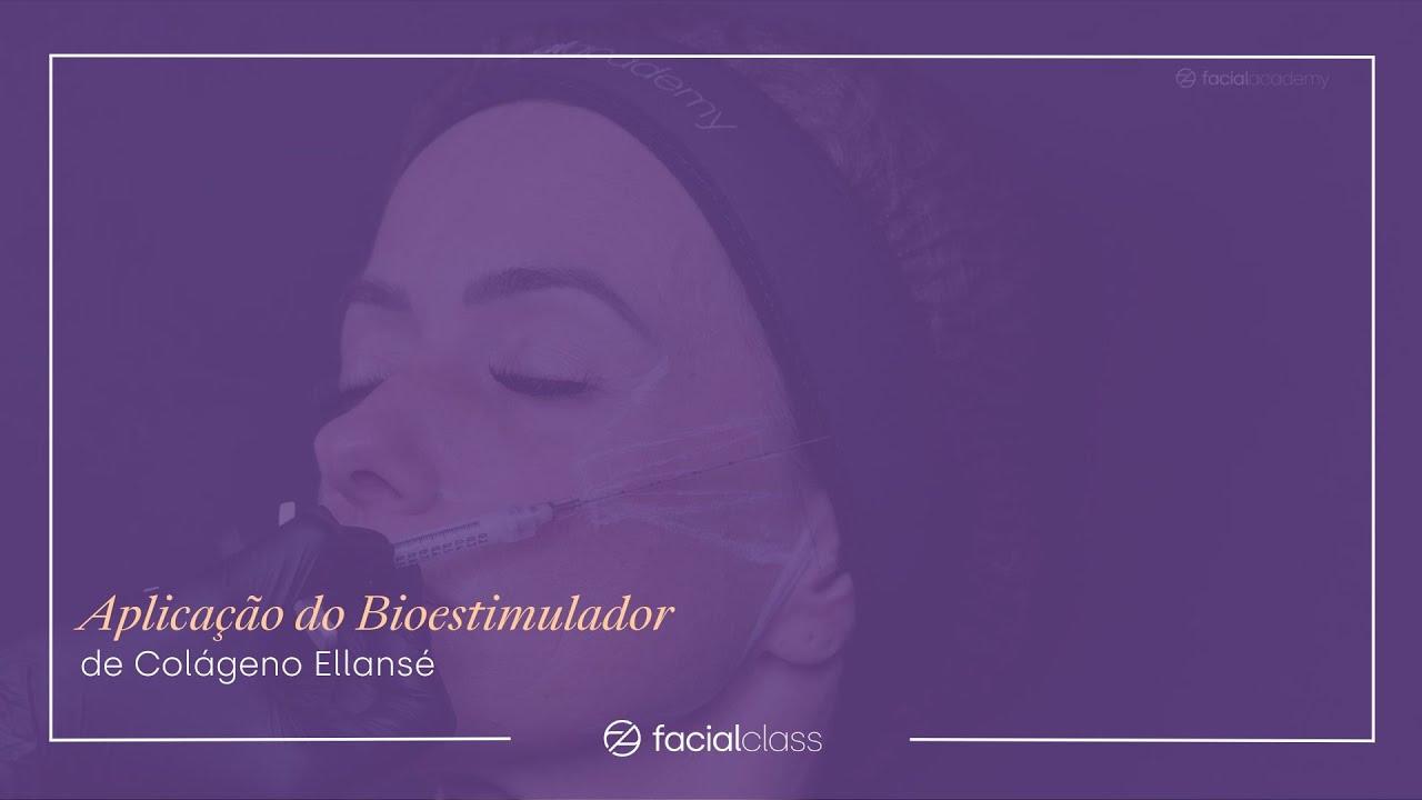Aplica&ccedil;&atilde;o do Bioestimulador de Col&aacute;geno Ellans&eacute; | Facial Class