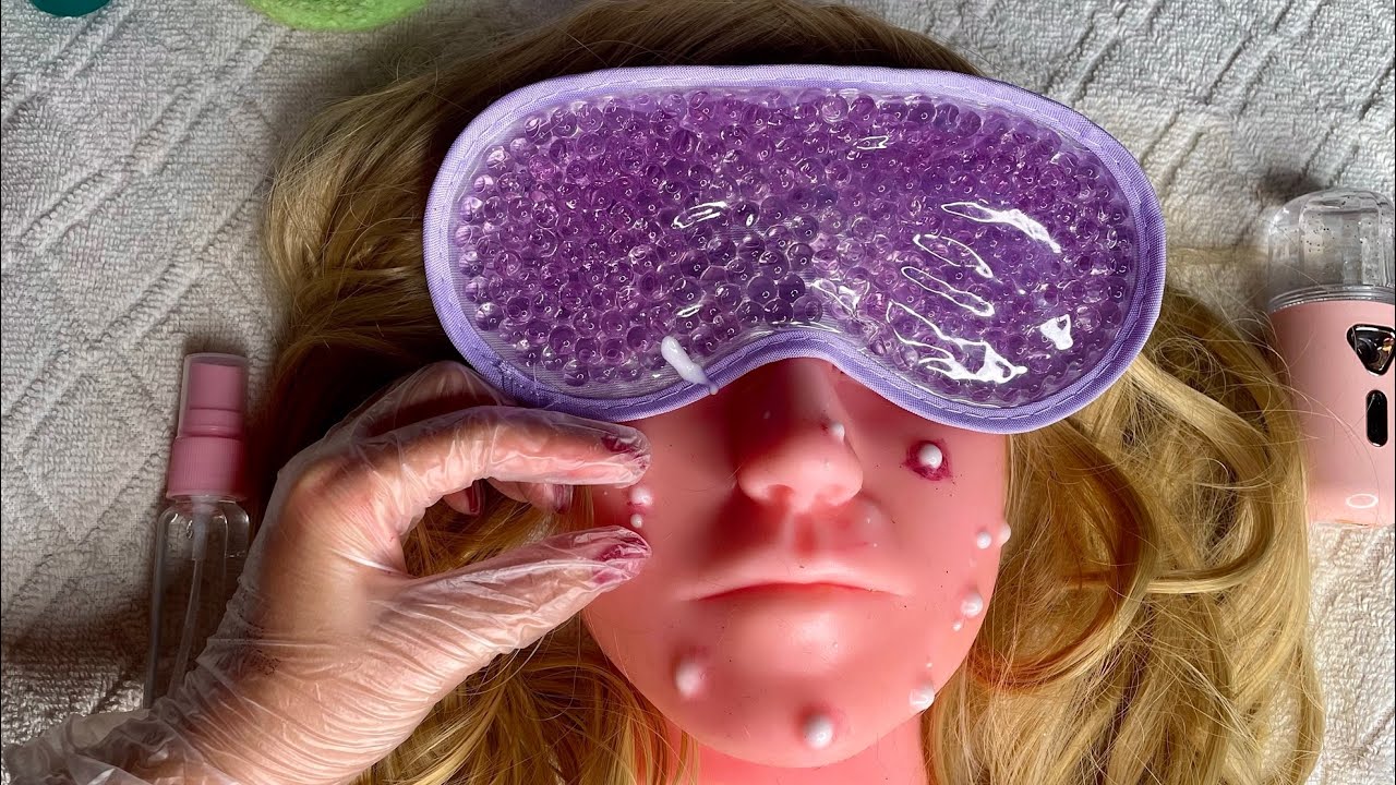 ASMR- REMOÇÃO DE ACNES RELAXANTE E SATISFATÓRIA