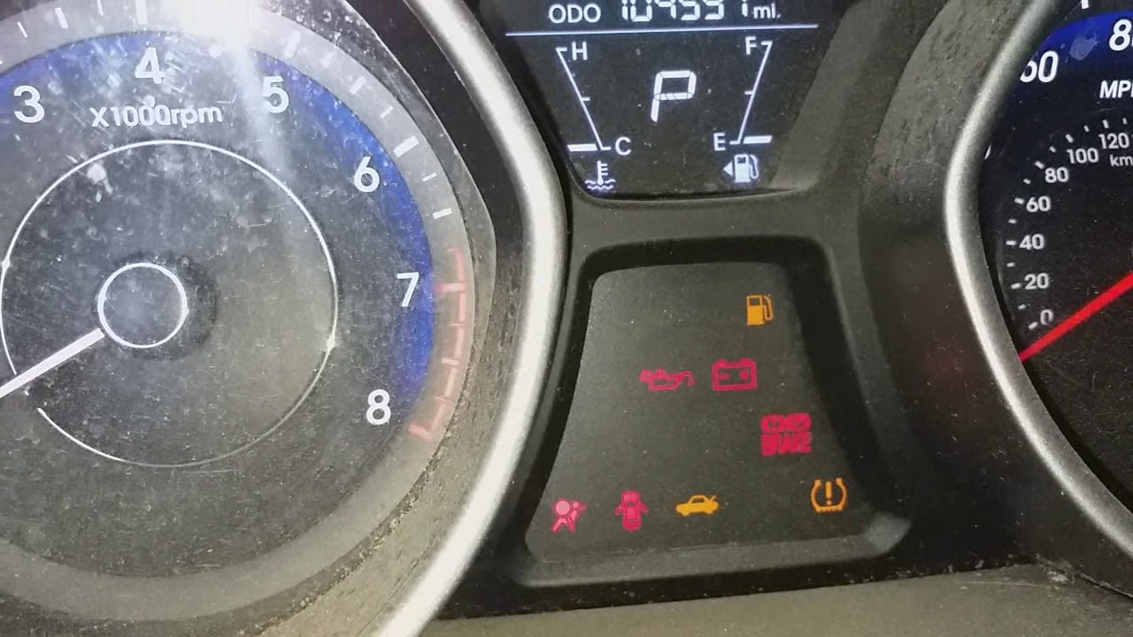 Falla de lubricación HYUNDAI ELANTRA 2013 parte 2
