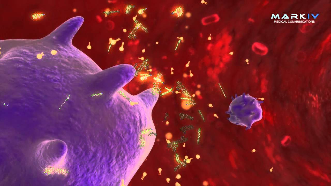 The Action Of Phosome (Liposomal Amphotericin B)